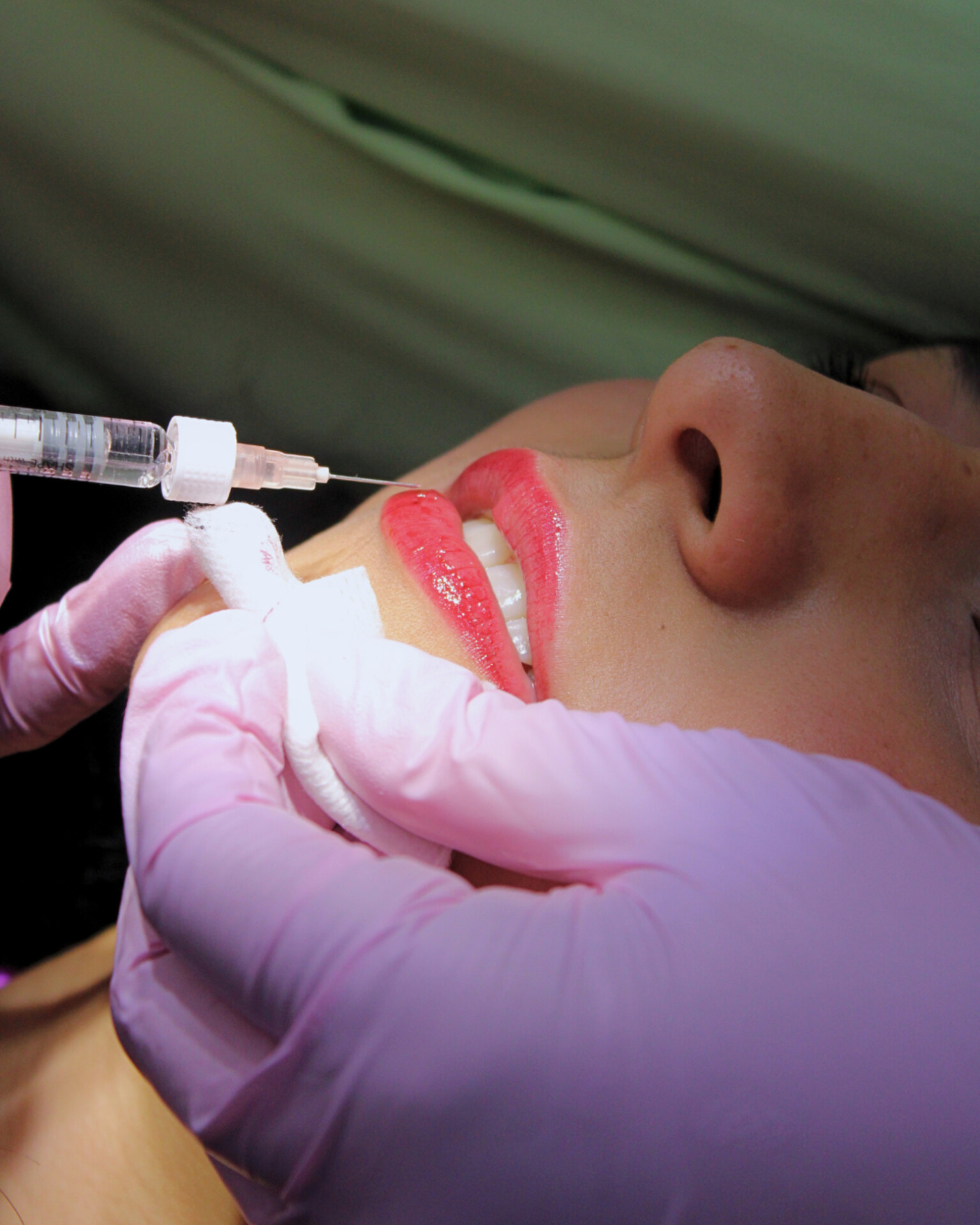 Armonización Orofacial y estética